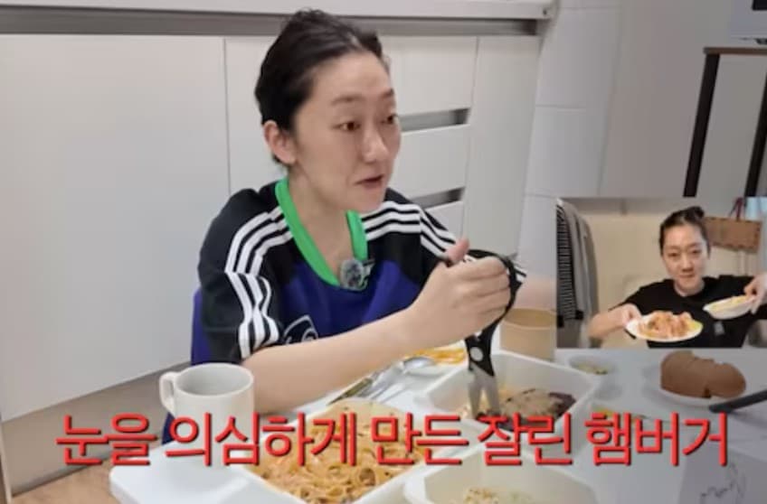 박경혜 양악수술