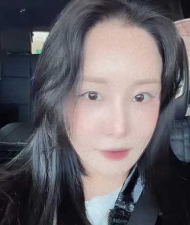 랄랄 세 번째 코 성형 수술